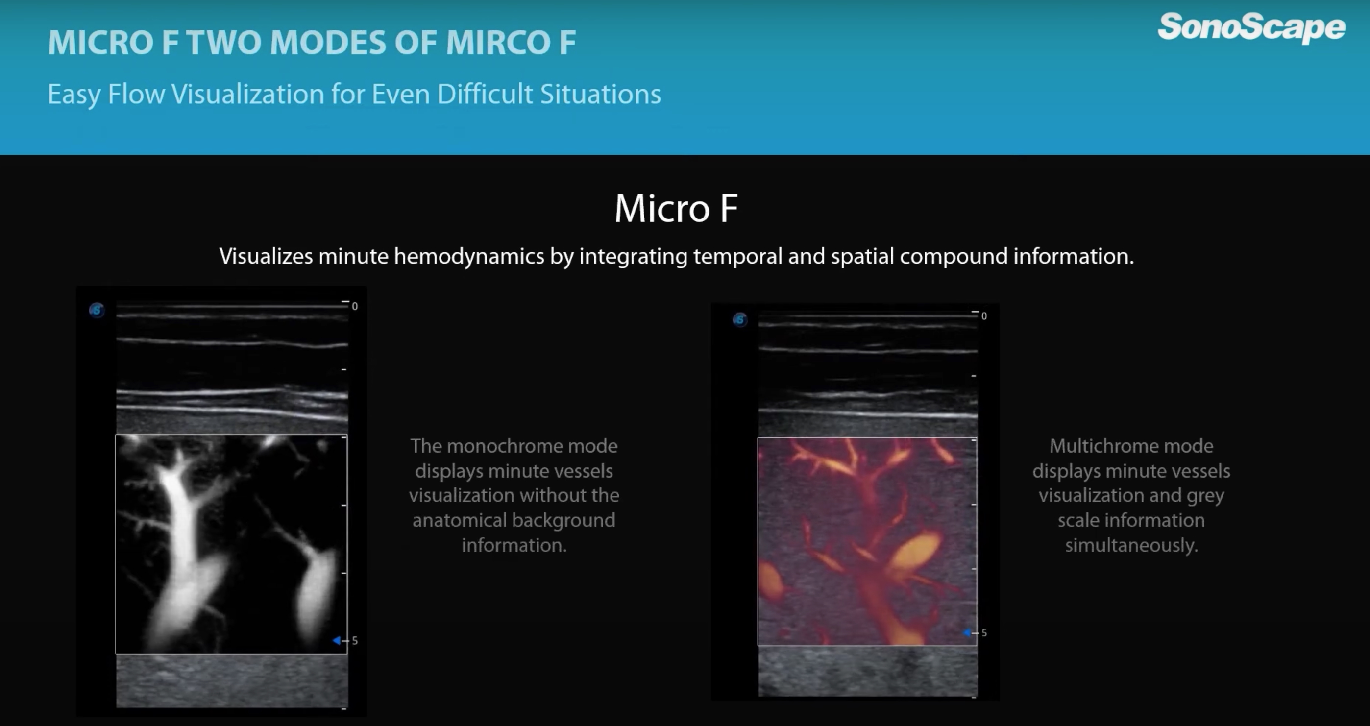 Micro F Two Modes Comparison